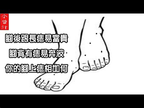 右腳踝有痣|腳上的運勢圖！腳底痣相圖解大全，腳底痣看你有幾分。